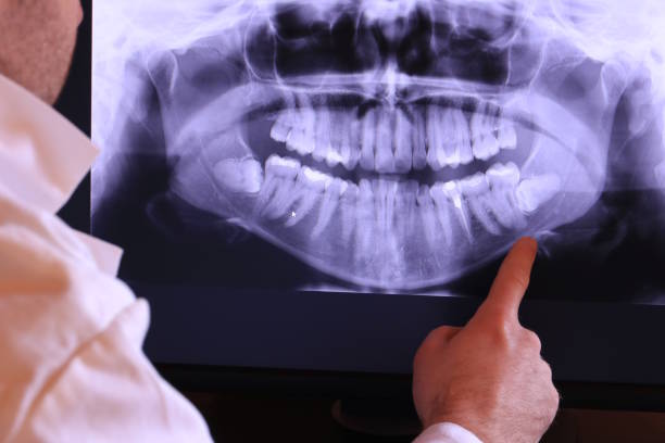 Best Emergency Dentist for Knocked-Out Tooth in Lakeland North, WA