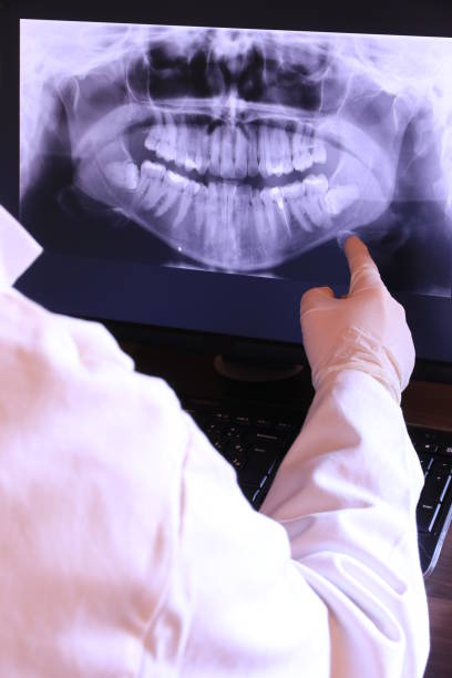 Best Emergency Root Canal Treatment in Lakeland North, WA
