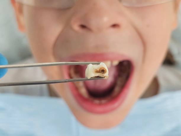 Best Orthodontic Emergency Dentist in Lakeland North, WA
